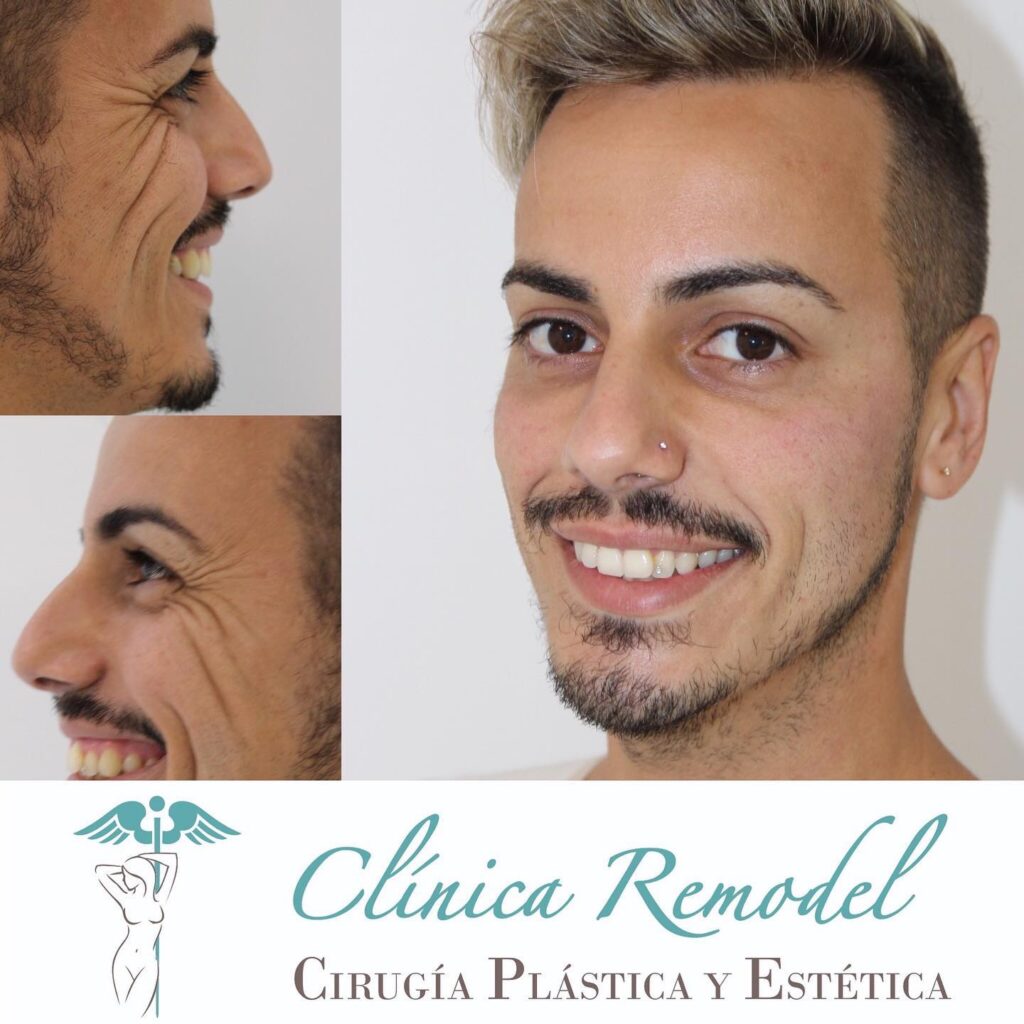 tratamientos faciales en las palmas